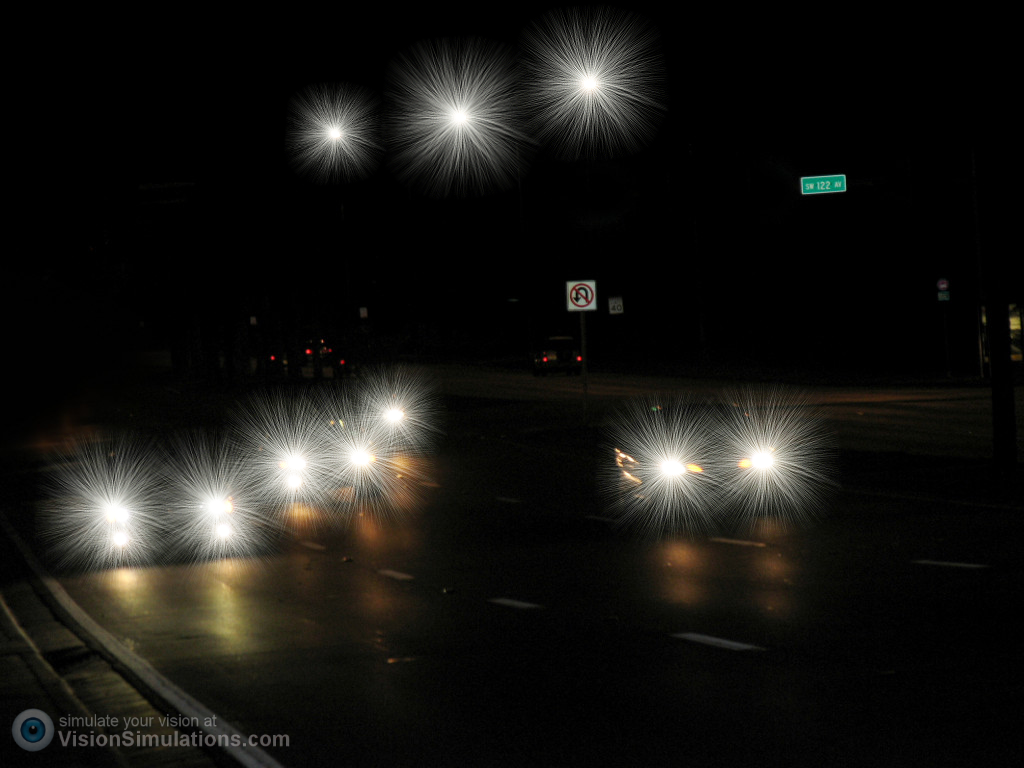 After LASIK - night driving with halos and starbursts