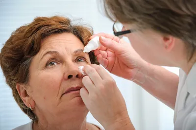 LASIK causes dry eye disease.